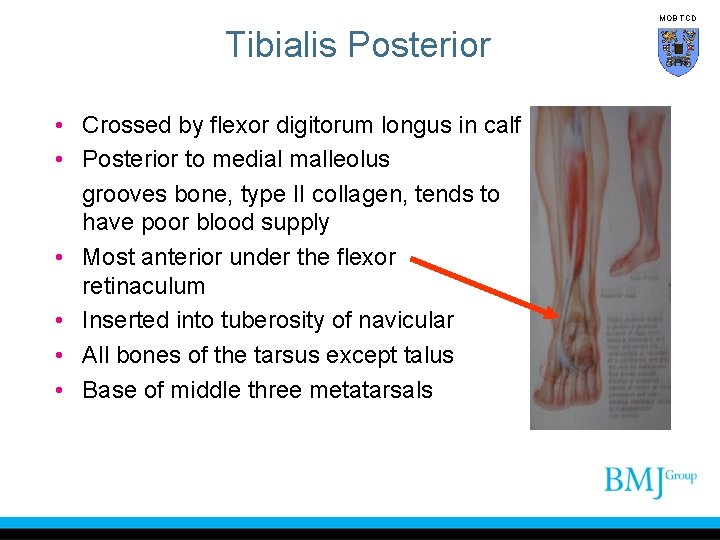 MOB TCD Tibialis Posterior • Crossed by flexor digitorum longus in calf • Posterior