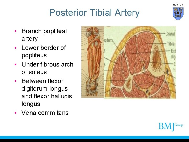 MOB TCD Posterior Tibial Artery • Branch popliteal artery • Lower border of popliteus