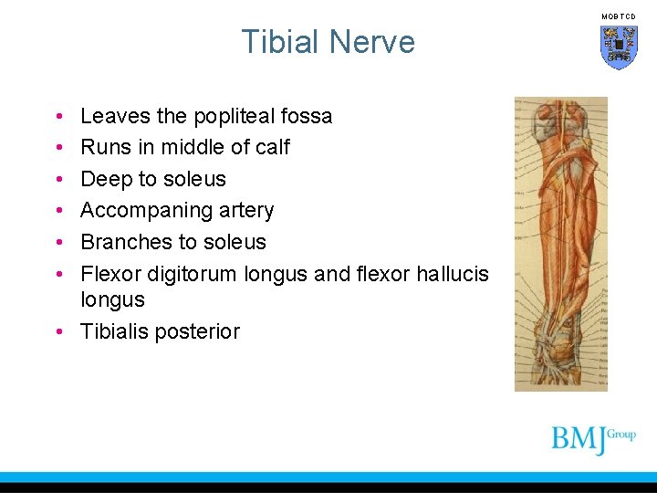 MOB TCD Tibial Nerve • • • Leaves the popliteal fossa Runs in middle