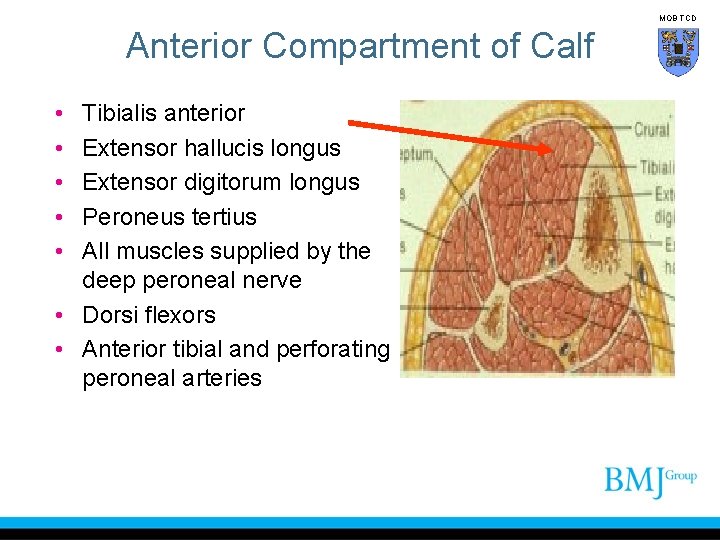 MOB TCD Anterior Compartment of Calf • • • Tibialis anterior Extensor hallucis longus