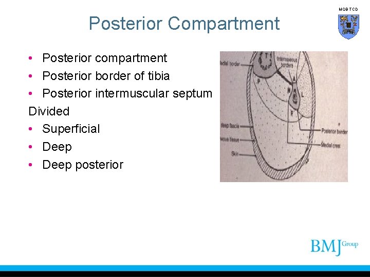 MOB TCD Posterior Compartment • Posterior compartment • Posterior border of tibia • Posterior