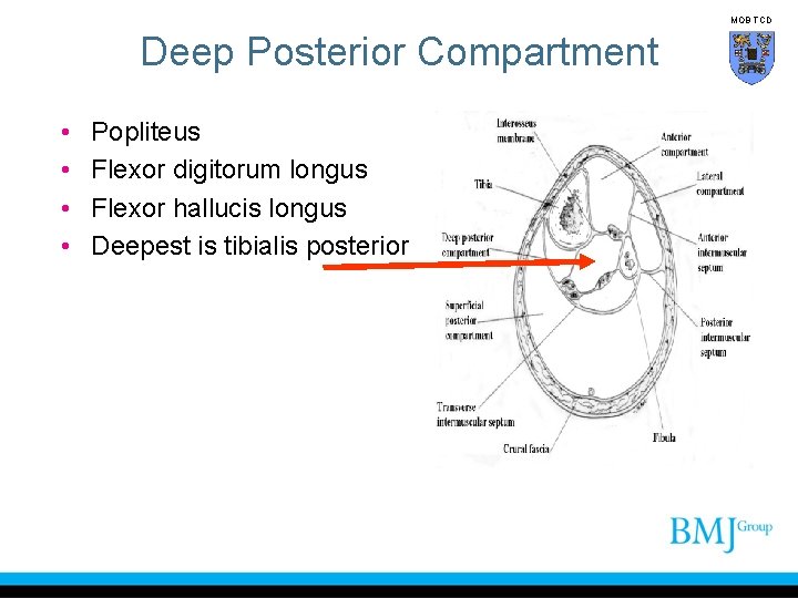 MOB TCD Deep Posterior Compartment • • Popliteus Flexor digitorum longus Flexor hallucis longus