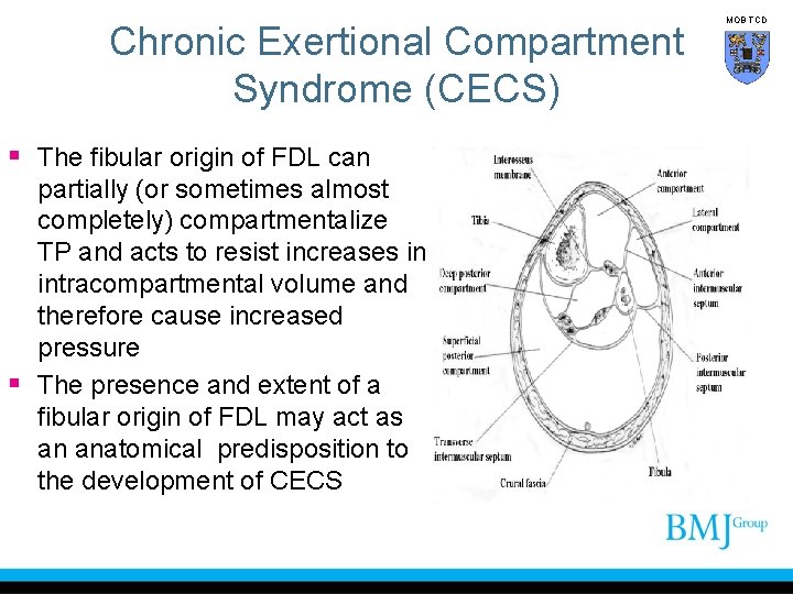 Chronic Exertional Compartment Syndrome (CECS) § The fibular origin of FDL can partially (or