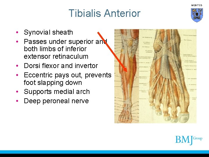 MOB TCD Tibialis Anterior • Synovial sheath • Passes under superior and both limbs