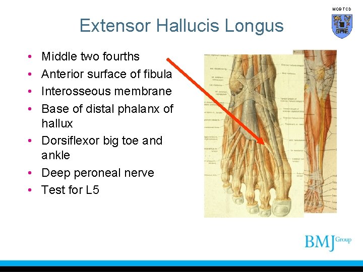 MOB TCD Extensor Hallucis Longus • • Middle two fourths Anterior surface of fibula