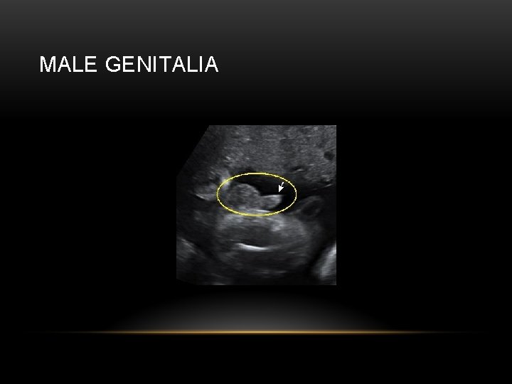 MALE GENITALIA 