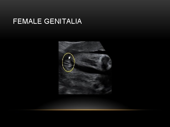 FEMALE GENITALIA 