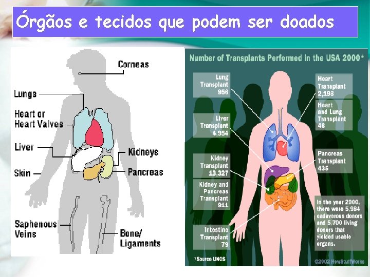 Órgãos e tecidos que podem ser doados 