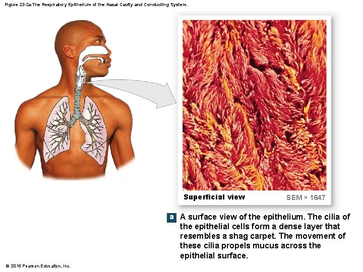 Figure 23 -2 a The Respiratory Epithelium of the Nasal Cavity and Conducting System.