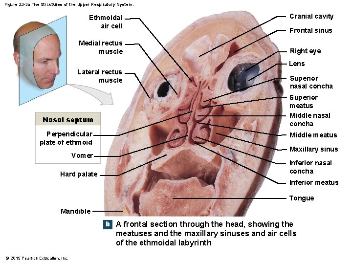 Figure 23 -3 b The Structures of the Upper Respiratory System. Ethmoidal air cell