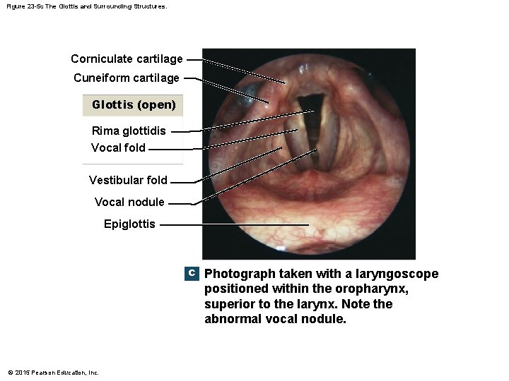 Figure 23 -5 c The Glottis and Surrounding Structures. Corniculate cartilage Cuneiform cartilage Glottis