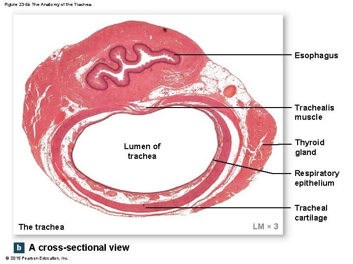 Figure 23 -6 b The Anatomy of the Trachea. Esophagus Trachealis muscle Thyroid gland