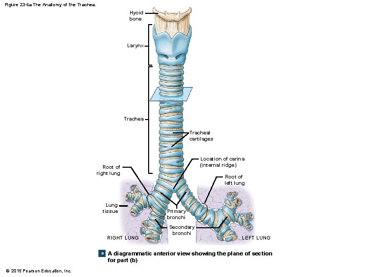 Figure 23 -6 a The Anatomy of the Trachea. Hyoid bone Larynx Tracheal cartilages
