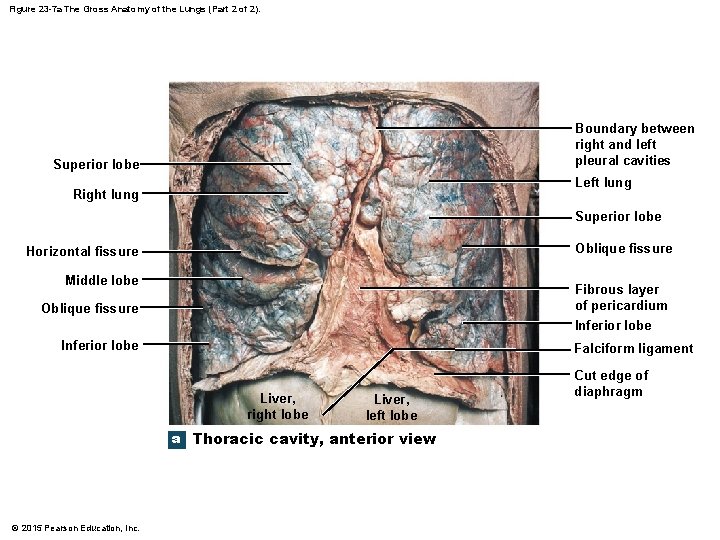 Figure 23 -7 a The Gross Anatomy of the Lungs (Part 2 of 2).