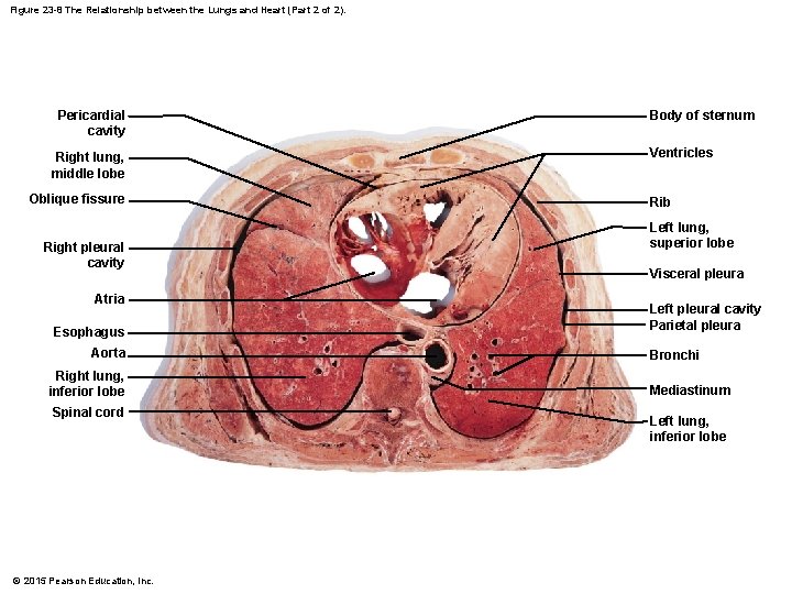 Figure 23 -8 The Relationship between the Lungs and Heart (Part 2 of 2).