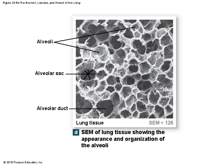 Figure 23 -9 d The Bronchi, Lobules, and Alveoli of the Lung. Alveoli Alveolar