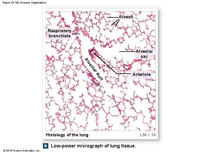 Figure 23 -10 b Alveolar Organization. Alveoli Respiratory bronchiole Alveolar sac a ol ve