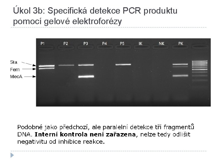 Úkol 3 b: Specifická detekce PCR produktu pomocí gelové elektroforézy 