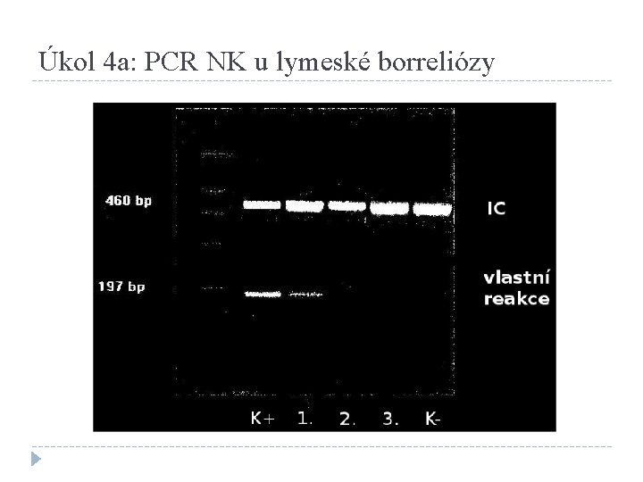 Úkol 4 a: PCR NK u lymeské borreliózy 