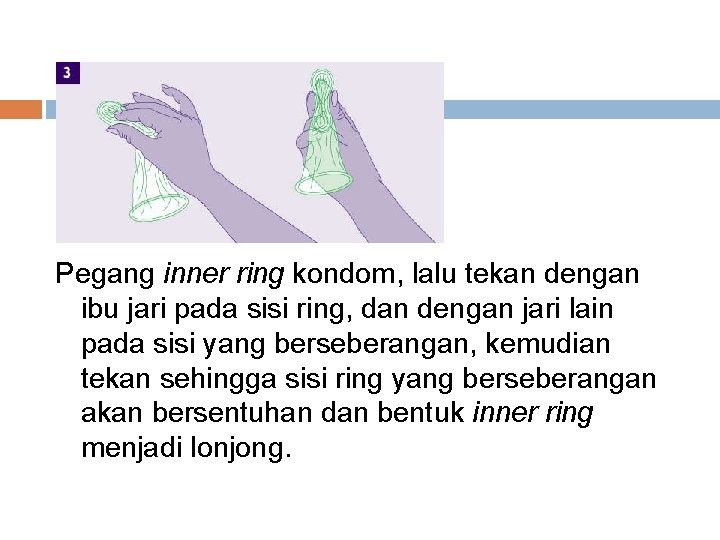 Pegang inner ring kondom, lalu tekan dengan ibu jari pada sisi ring, dan dengan