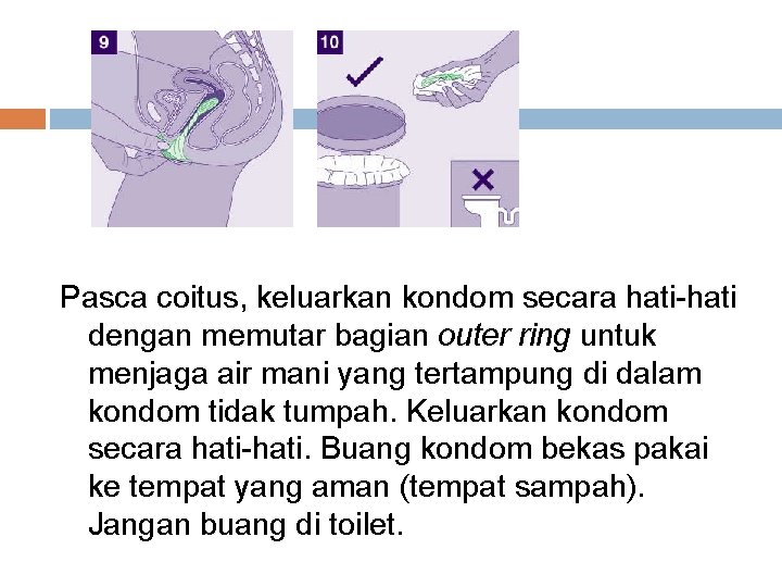 Pasca coitus, keluarkan kondom secara hati-hati dengan memutar bagian outer ring untuk menjaga air