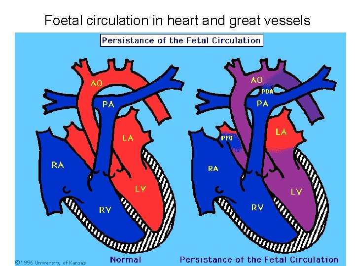 Foetal circulation in heart and great vessels 