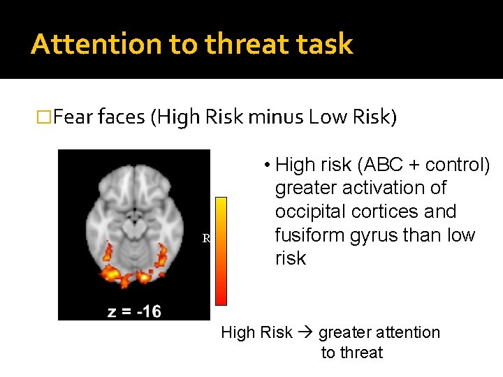 Attention to threat task �Fear faces (High Risk minus Low Risk) R • High