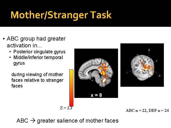 Mother/Stranger Task • ABC group had greater activation in… • Posterior cingulate gyrus •