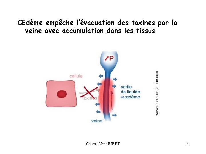 Œdème empêche l’évacuation des toxines par la veine avec accumulation dans les tissus Cours