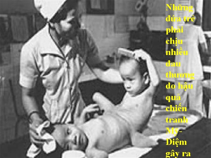 Những đứa trẻ phải chịu nhiều đau thương do hậu quả chiến tranh MỹDiệm