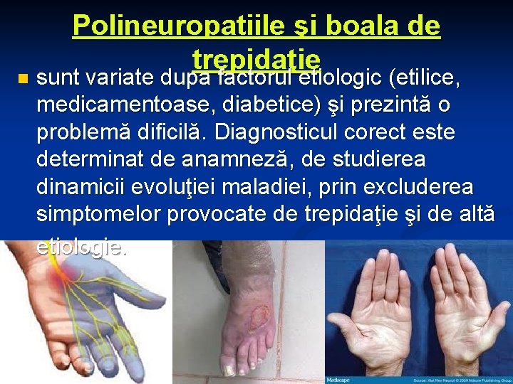 n Polineuropatiile şi boala de trepidaţie sunt variate dupa factorul etiologic (etilice, medicamentoase, diabetice)