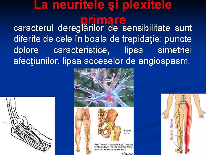 La neuritele şi plexitele primare caracterul dereglărilor de sensibilitate sunt diferite de cele în