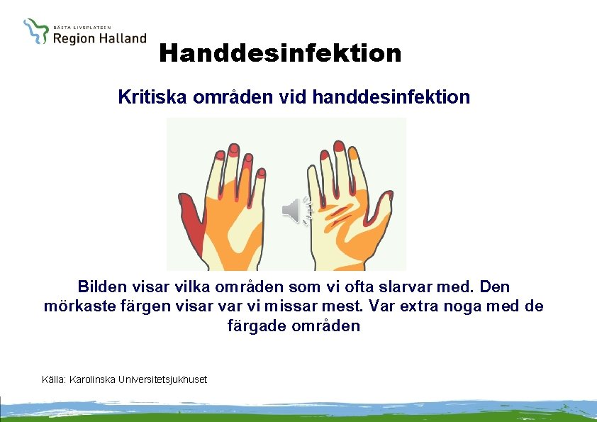 Handdesinfektion Kritiska områden vid handdesinfektion Bilden visar vilka områden som vi ofta slarvar med.