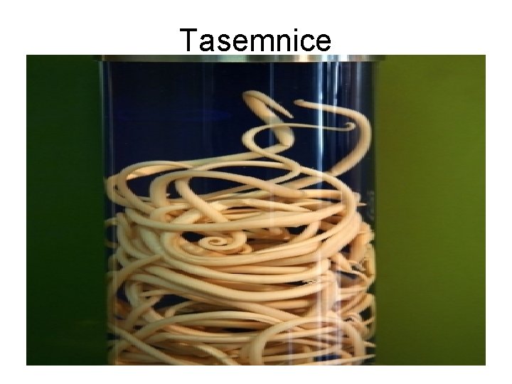 Tasemnice 