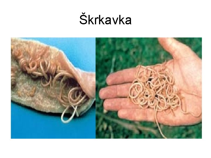 Škrkavka 