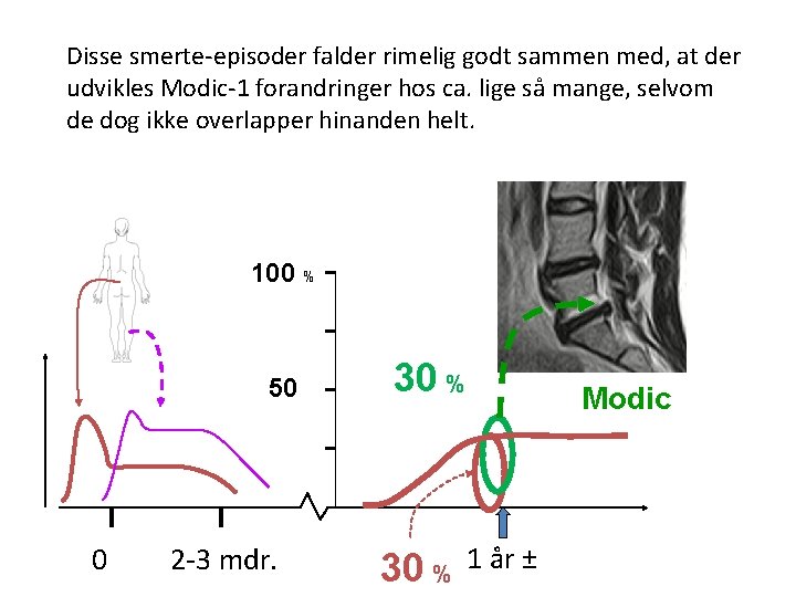 Disse smerte-episoder falder rimelig godt sammen med, at der udvikles Modic-1 forandringer hos ca.