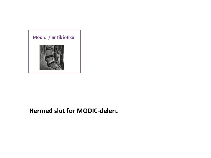 Modic / antibiotika Hermed slut for MODIC-delen. 