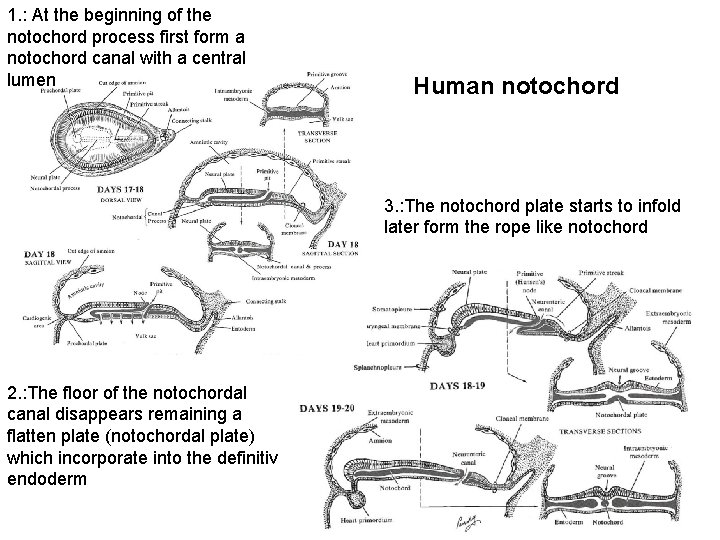 1. : At the beginning of the notochord process first form a notochord canal