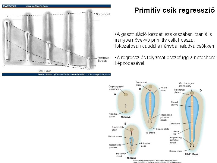 Primitív csík regresszió • A gasztruláció kezdeti szakaszában craniális irányba növekvő primitív csík hossza,