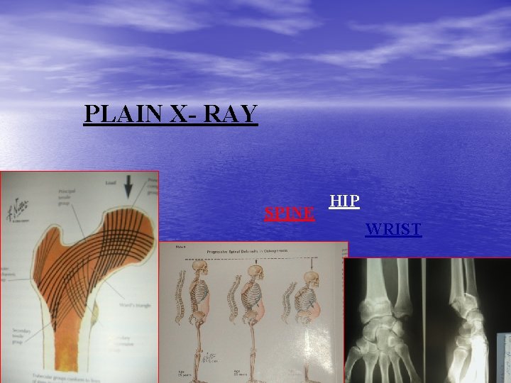 PLAIN X- RAY SPINE HIP WRIST 