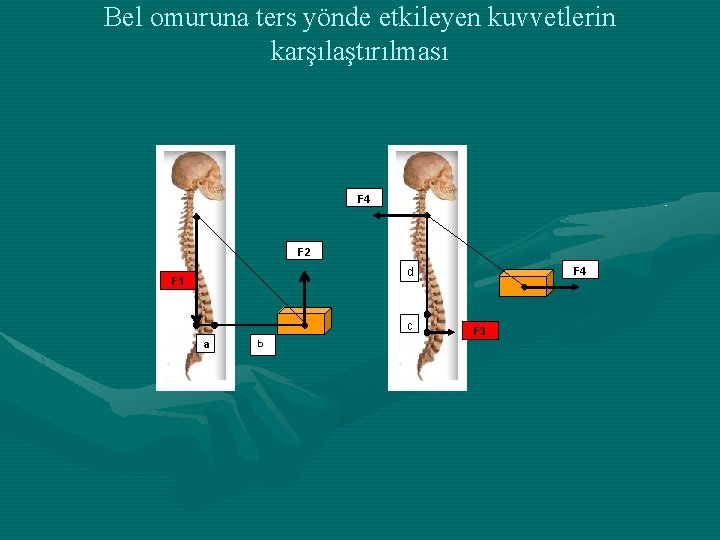 Bel omuruna ters yönde etkileyen kuvvetlerin karşılaştırılması F 4 F 2 F 4 d