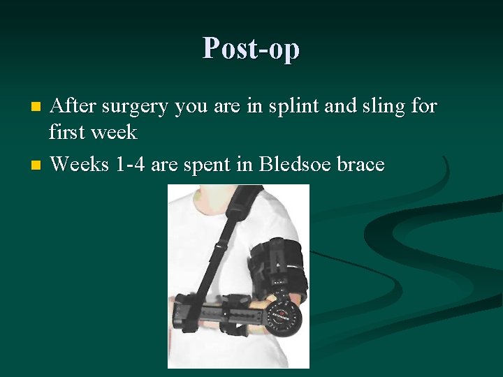 Post-op After surgery you are in splint and sling for first week n Weeks