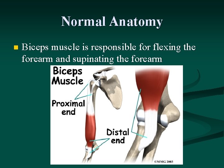 Normal Anatomy n Biceps muscle is responsible for flexing the forearm and supinating the