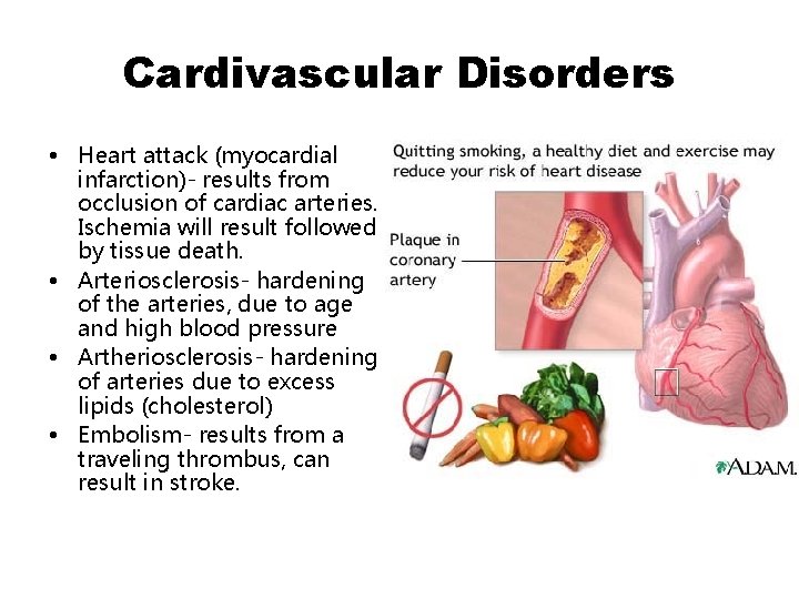 Cardivascular Disorders • Heart attack (myocardial infarction)- results from occlusion of cardiac arteries. Ischemia