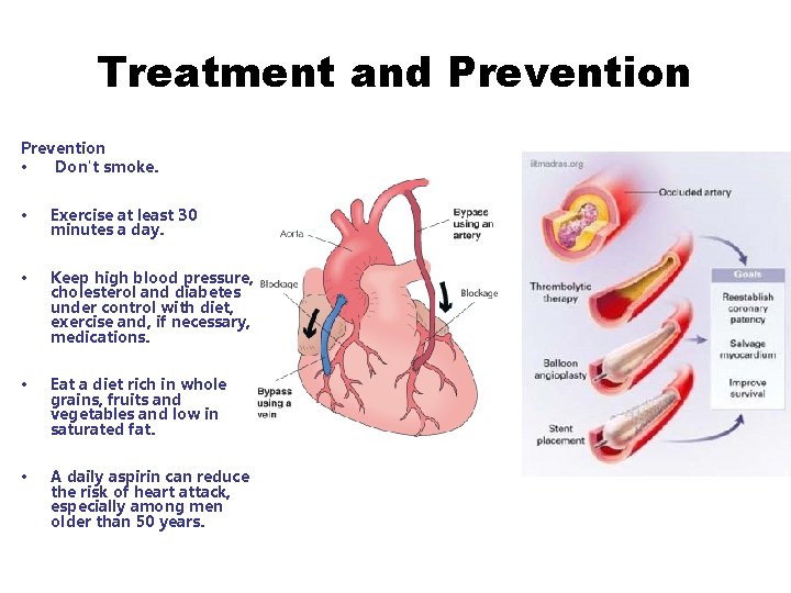 Treatment and Prevention • Don't smoke. • Exercise at least 30 minutes a day.