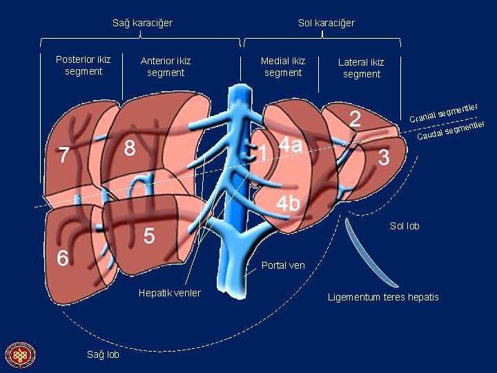 Sağ karaciğer Posterior ikiz segment Anterior ikiz segment Sol karaciğer Medial ikiz segment Lateral