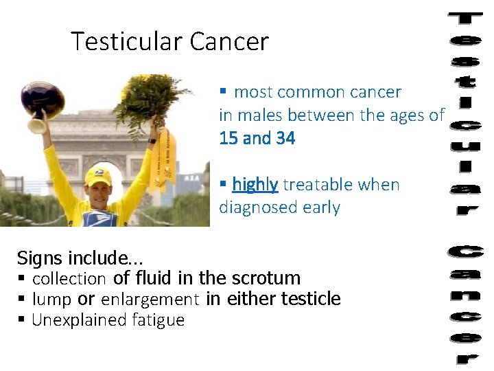 Testicular Cancer § most common cancer in males between the ages of 15 and