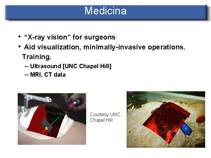 Medicina • “X-ray vision” for surgeons • Aid visualization, minimally-invasive operations. Training. – Ultrasound