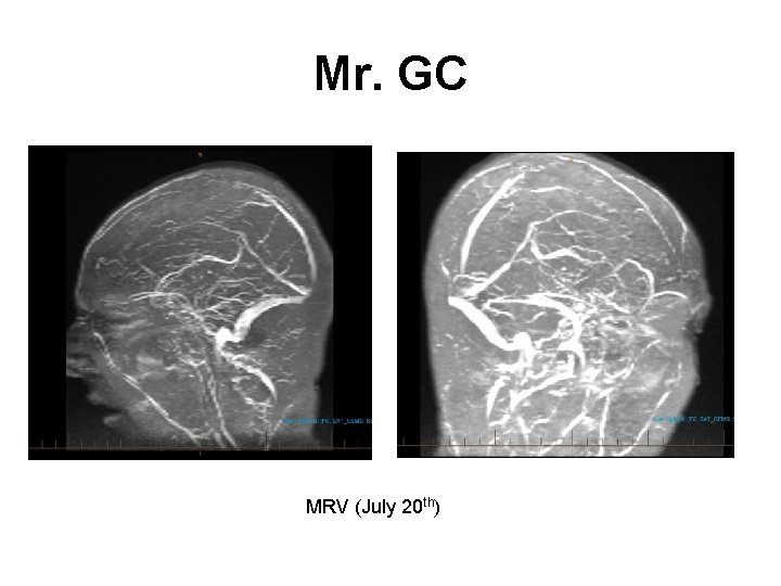 Mr. GC MRV (July 20 th) 