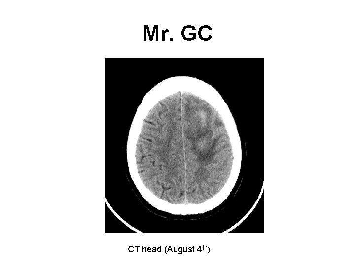 Mr. GC CT head (August 4 th) 